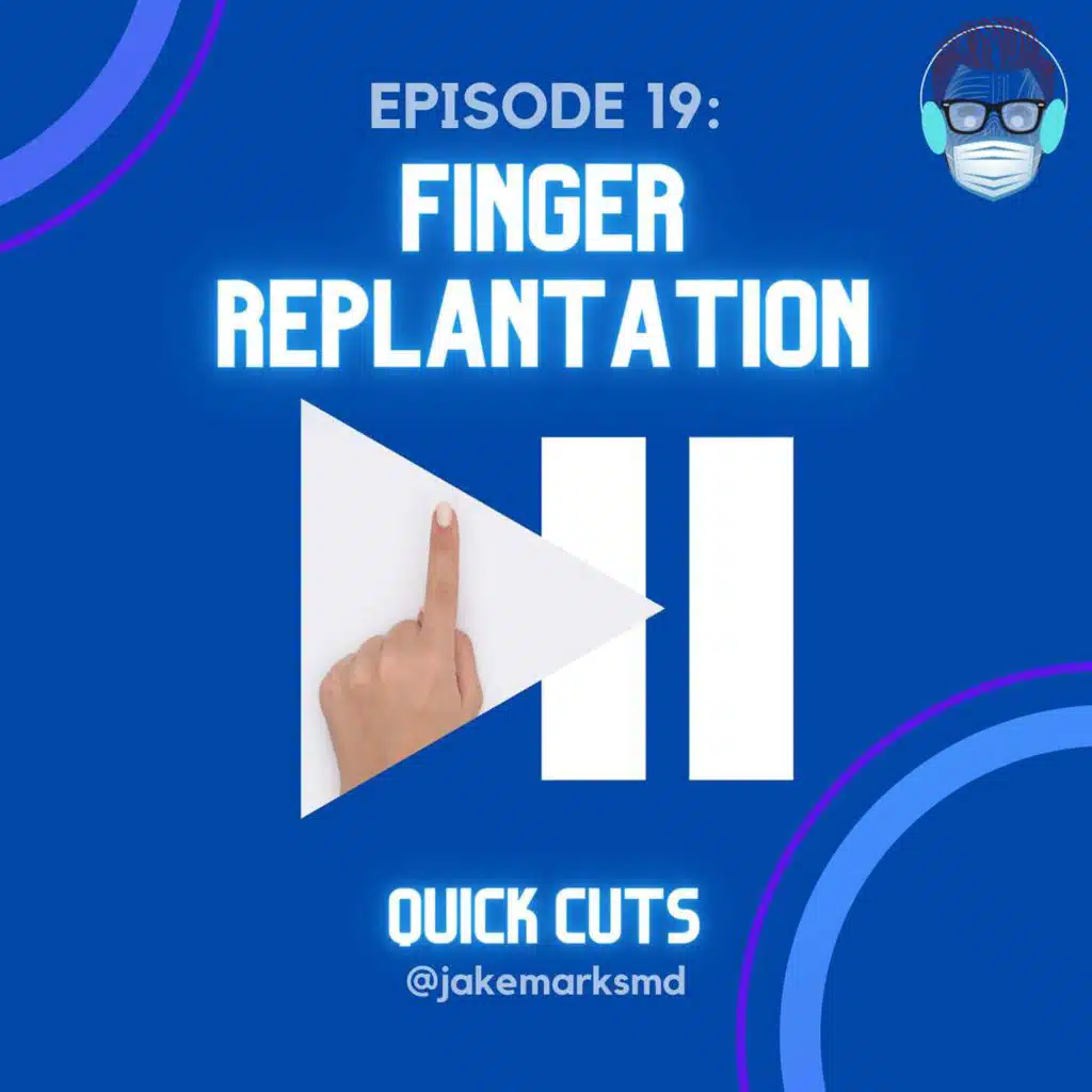 Episode 19: Finger Replantation