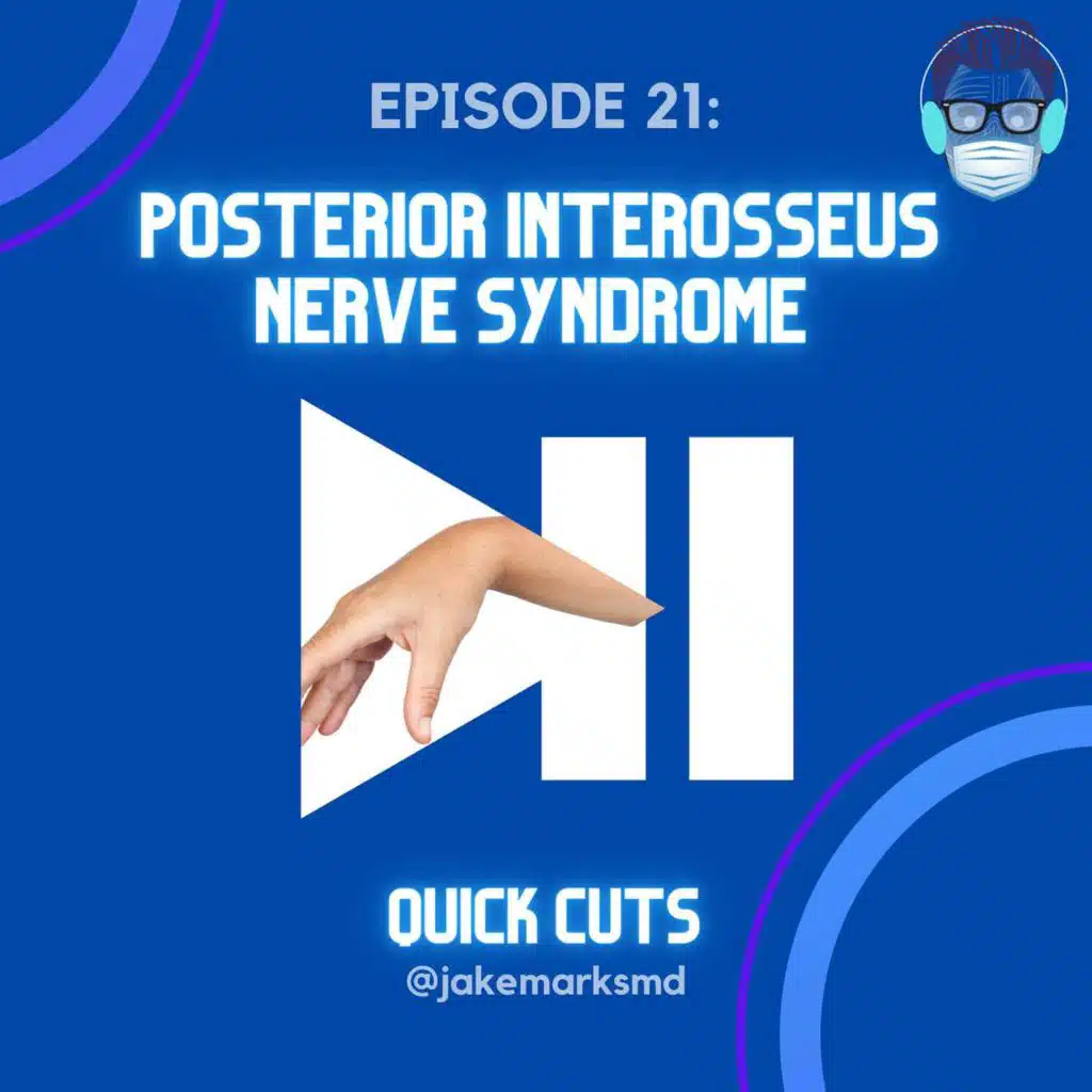 Episode 21: Posterior Interosseous Nerve Syndrome