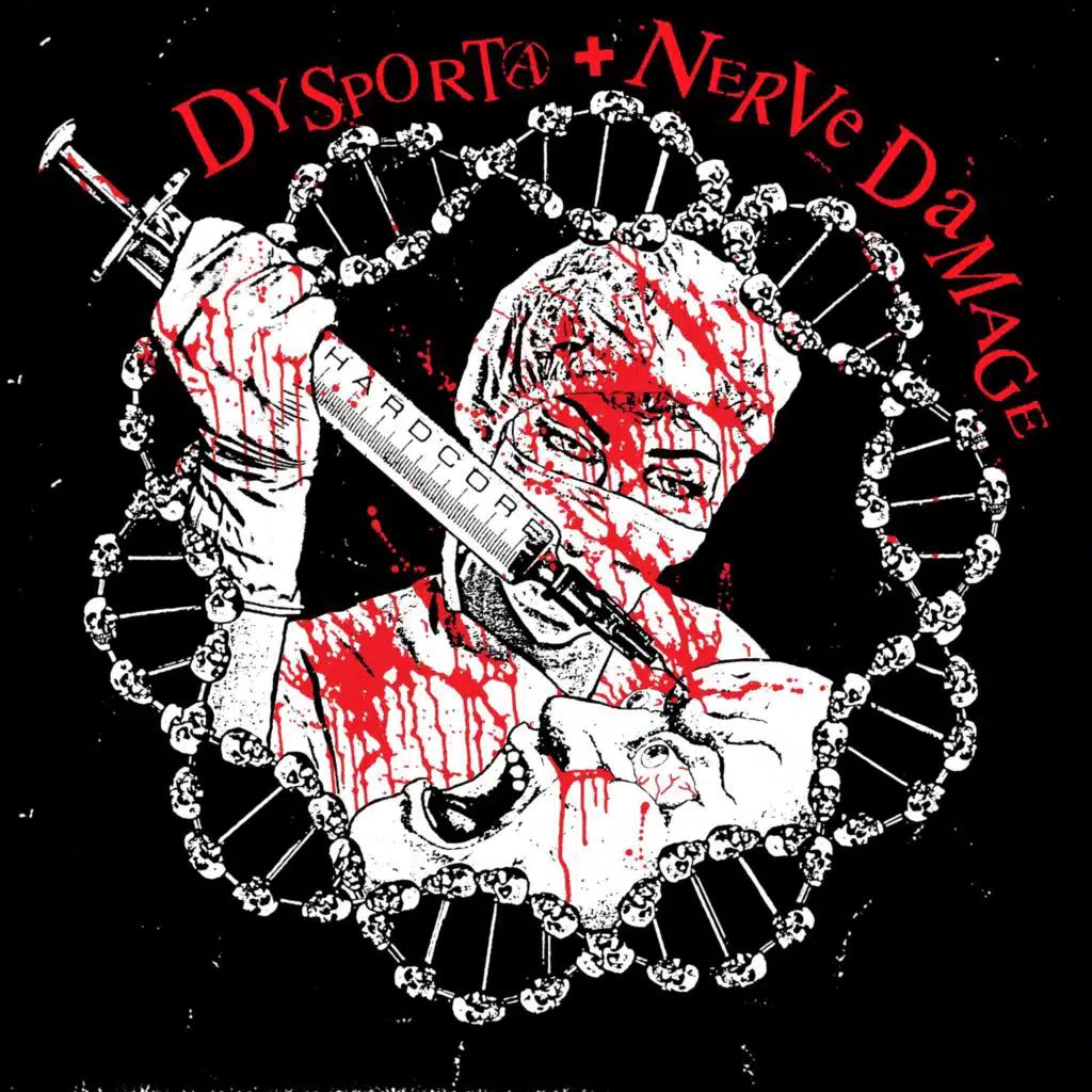 Dysporta + Nerve Damage