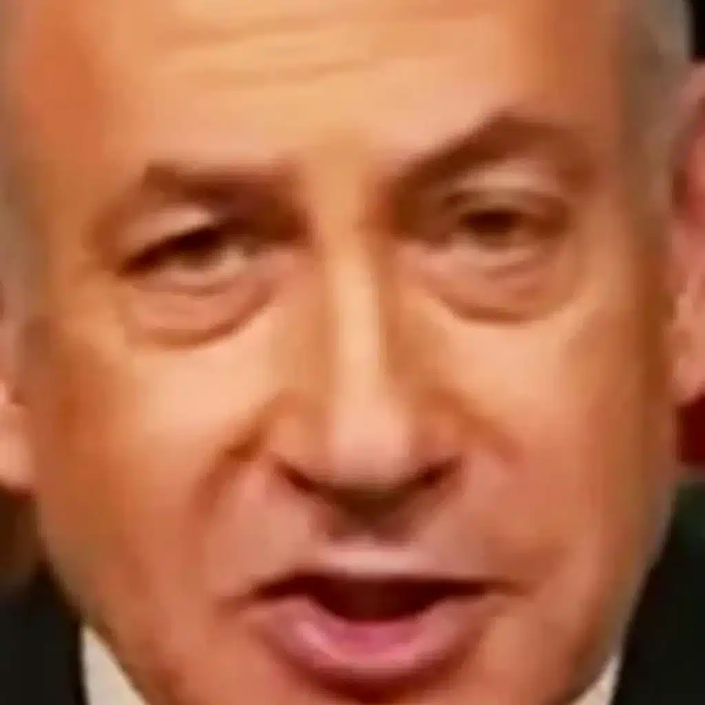 Bibi Gets Berned