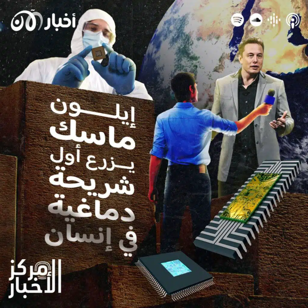 شركة إيلون ماسك تنجح بزراعة أول شريحة دماغية في إنسان