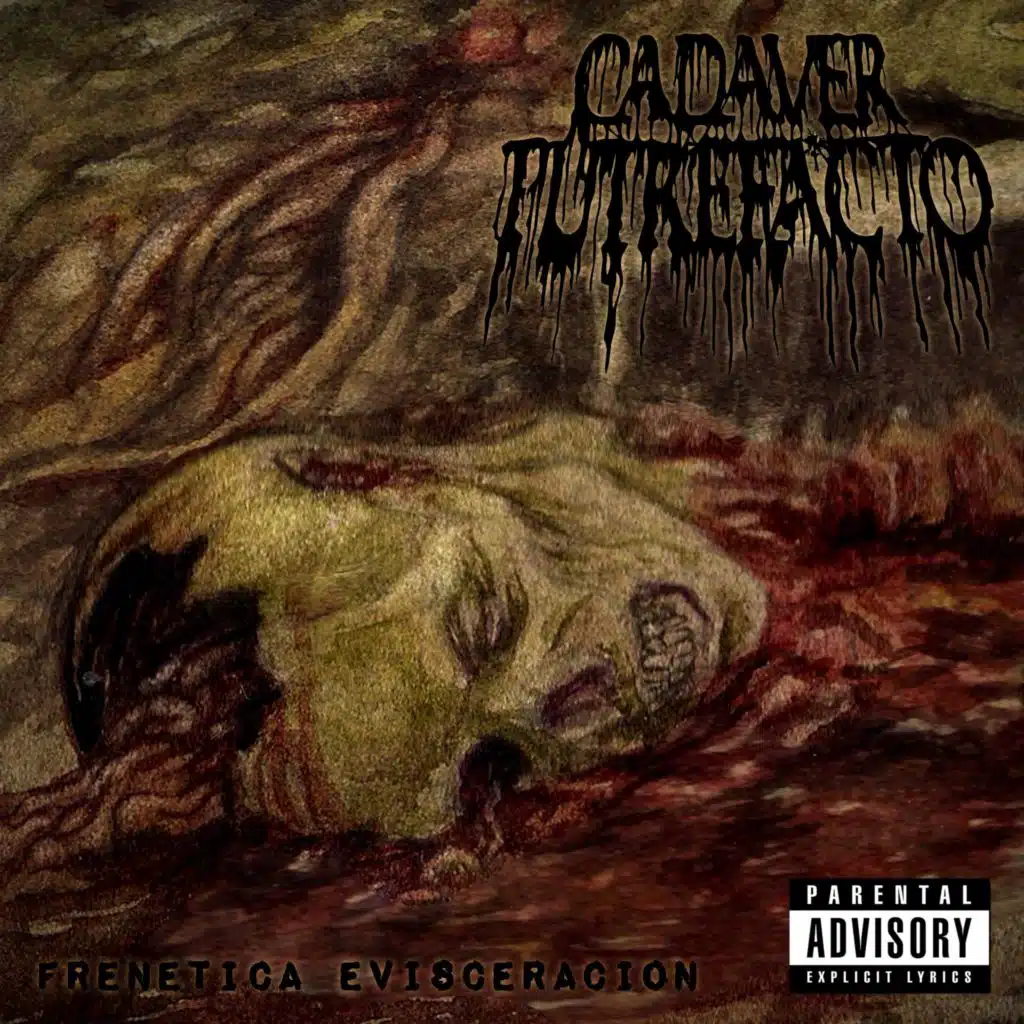 Cadaver Putrefacto