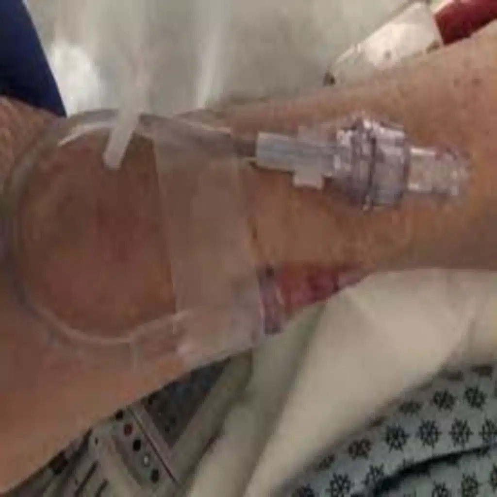 Podcast 830: Peripheral IV Flow Rates