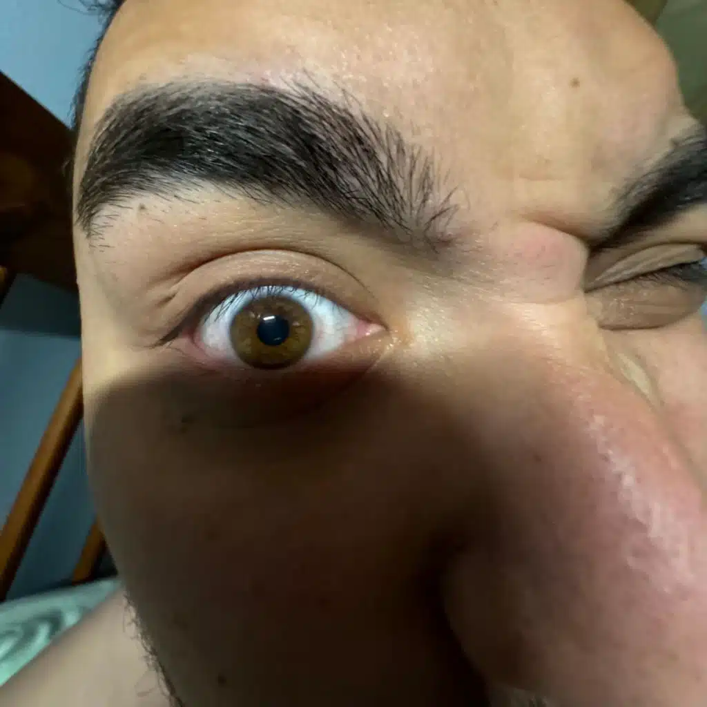 Ya Fox, Return to Monke