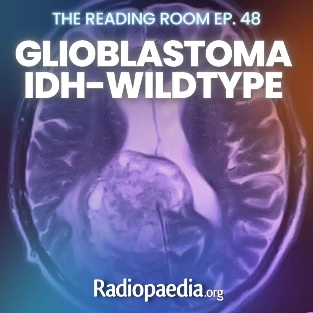 48. Readful! Glioblastoma with Frank Gaillard