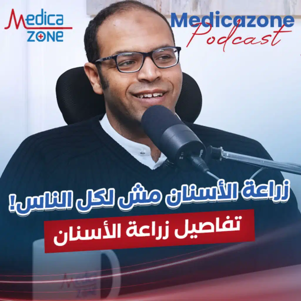 تفاصيل زراعة الأسنان| د/محمد حمدي