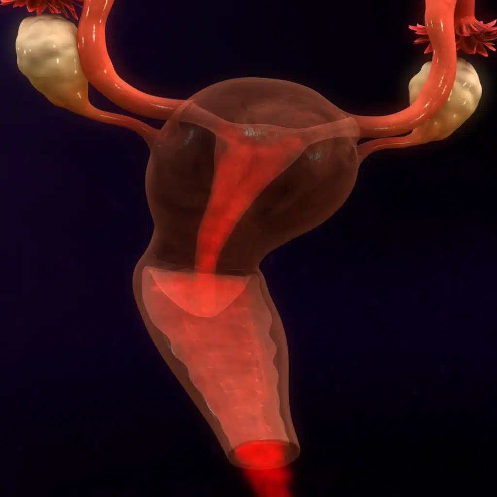 Abnormal Uterine Bleeding
