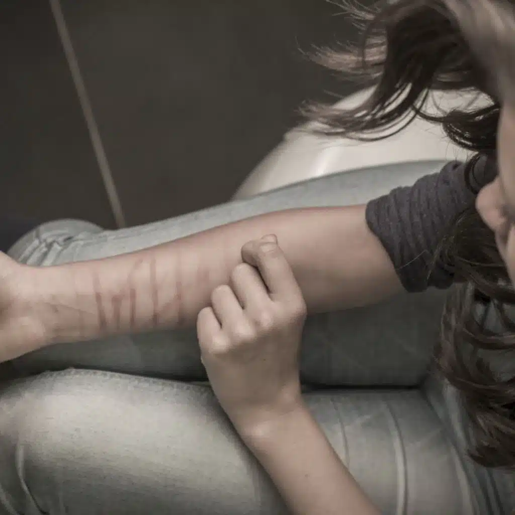 EKU Podcast: Self-harm