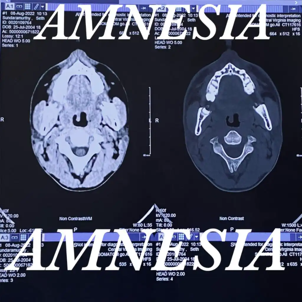 Amnésia