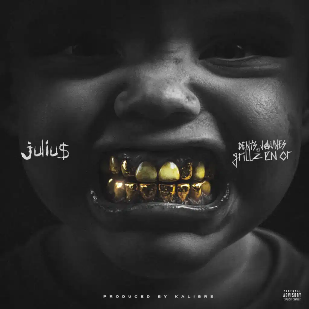 Dents Jaunes & Grillz en Or