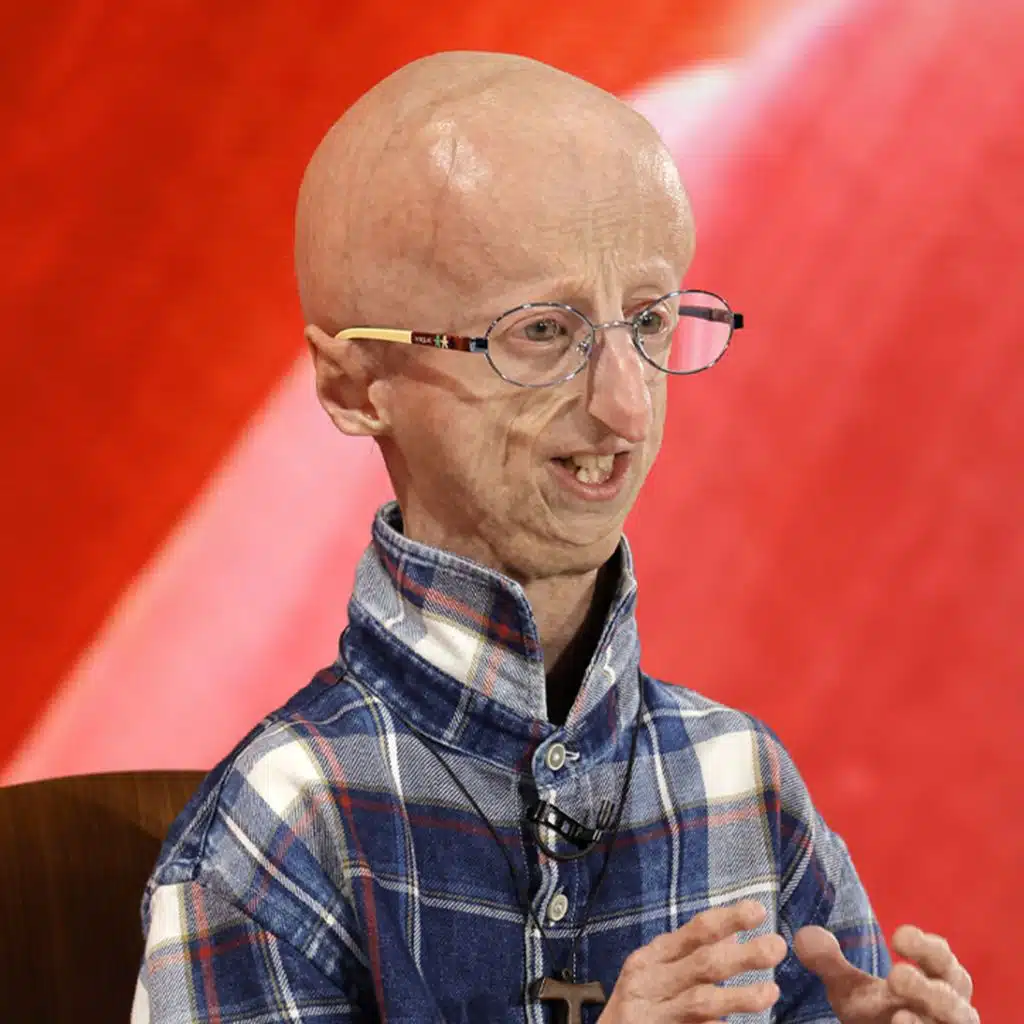 Sammy Basso on the Power of Positive Thinking