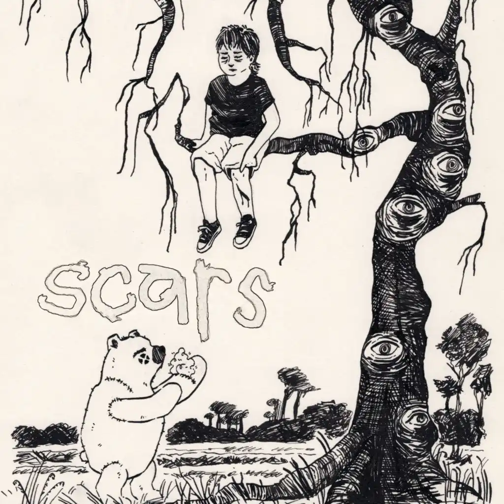 Scars