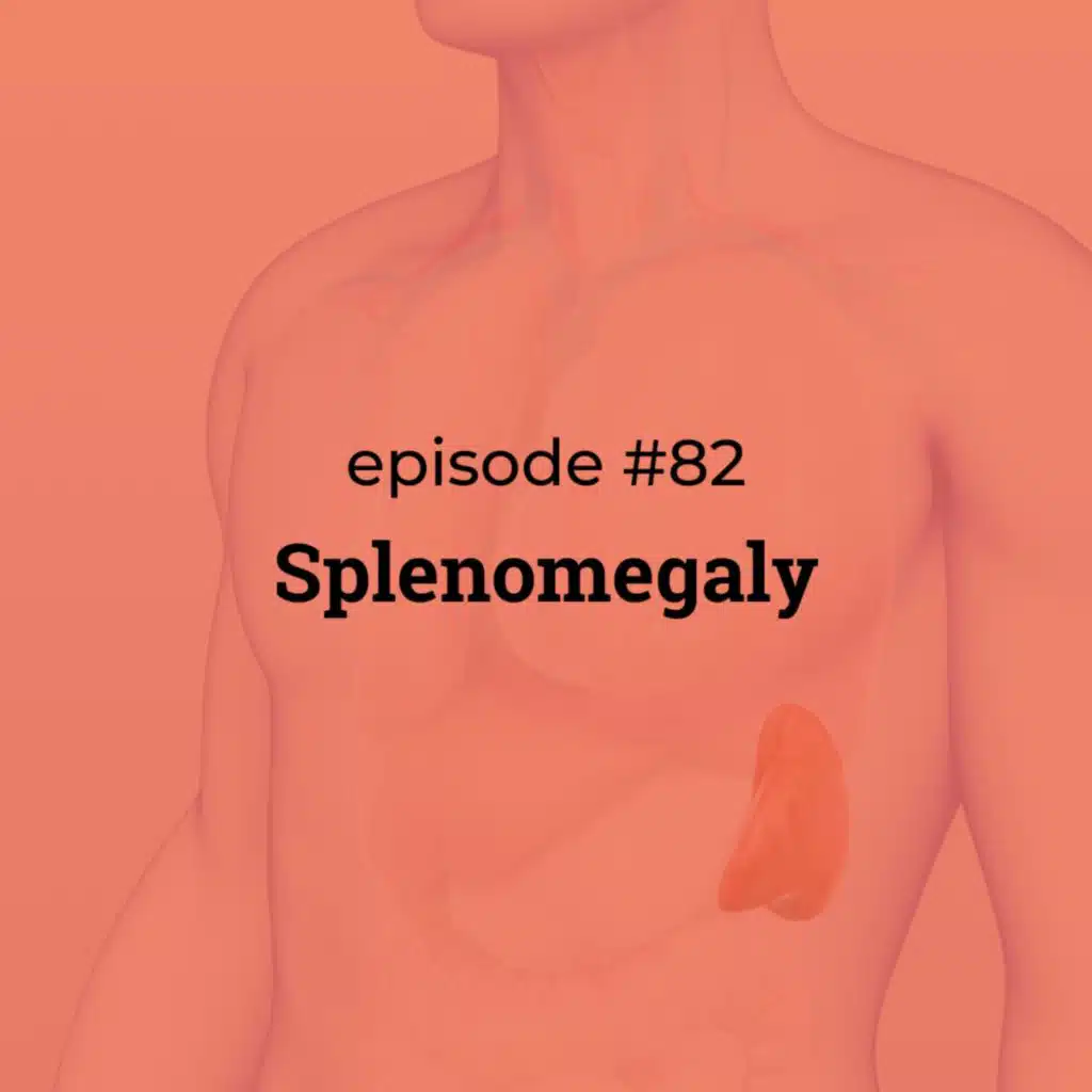 #82 Splenomegaly