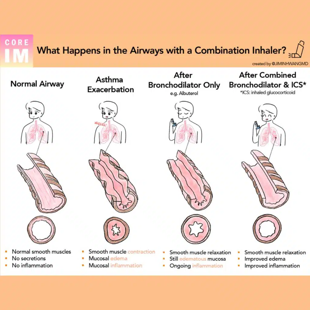 #149 Asthma Management and the MANDALA Trial: Beyond Journal Club with NEJM Group