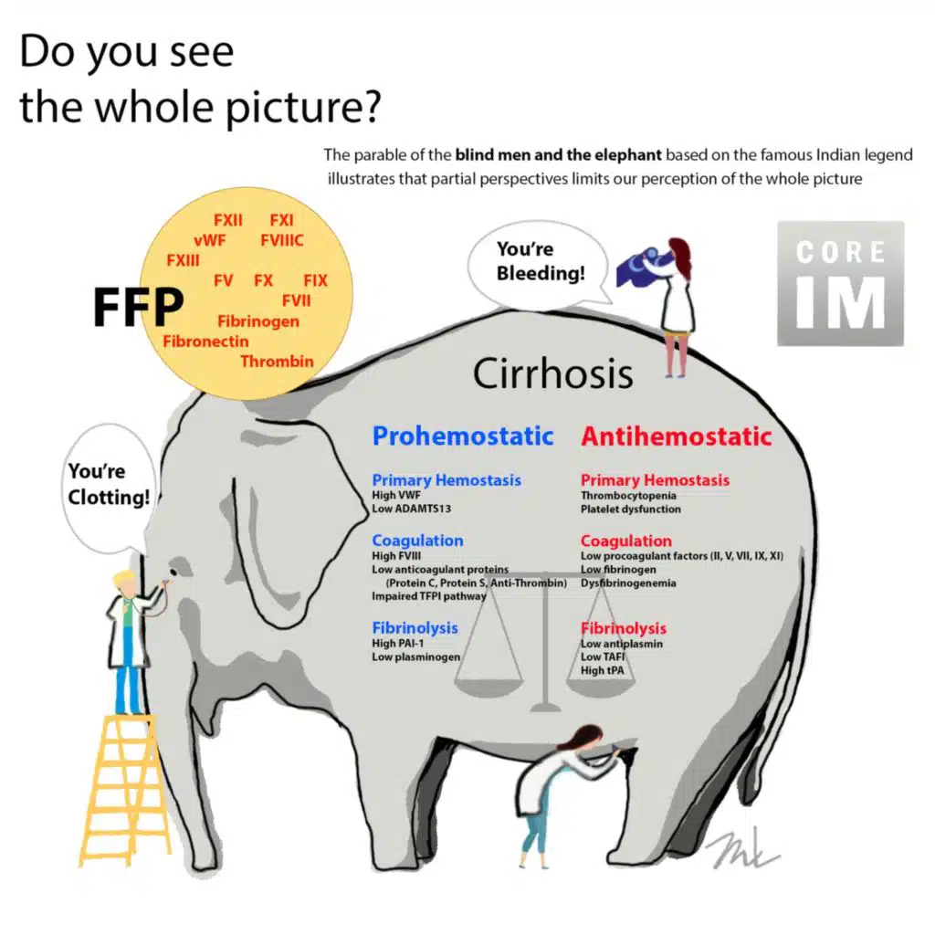 #128 Cirrhosis Bleeding Risk, FFP and Indwelling Pleural Catheters: Gray Matters Segments