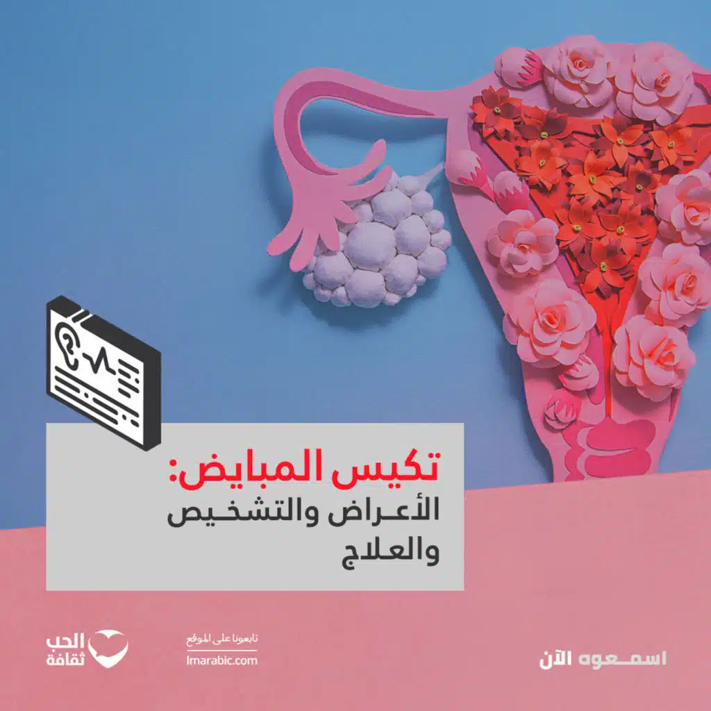 تكيس المبايض: الأعراض والتشخيص والعلاج