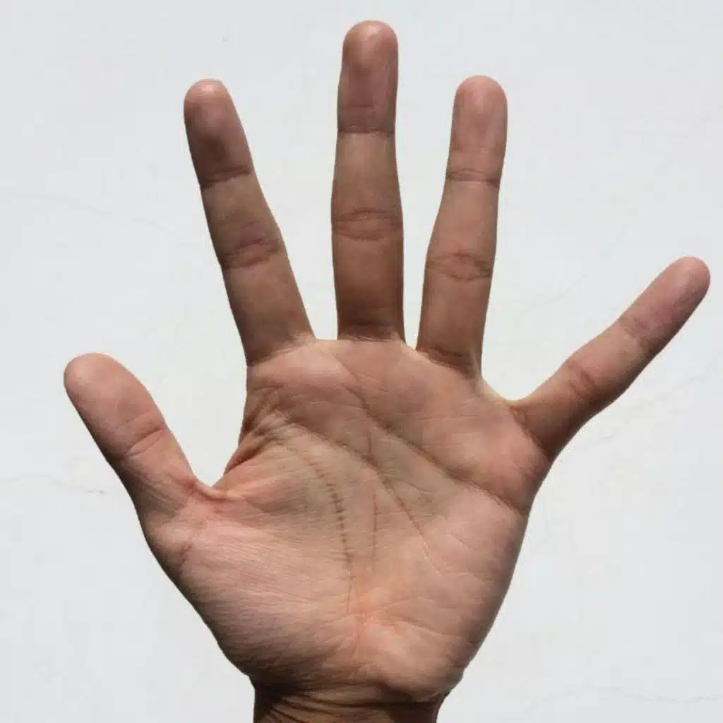Is cracking my knuckles bad for me?