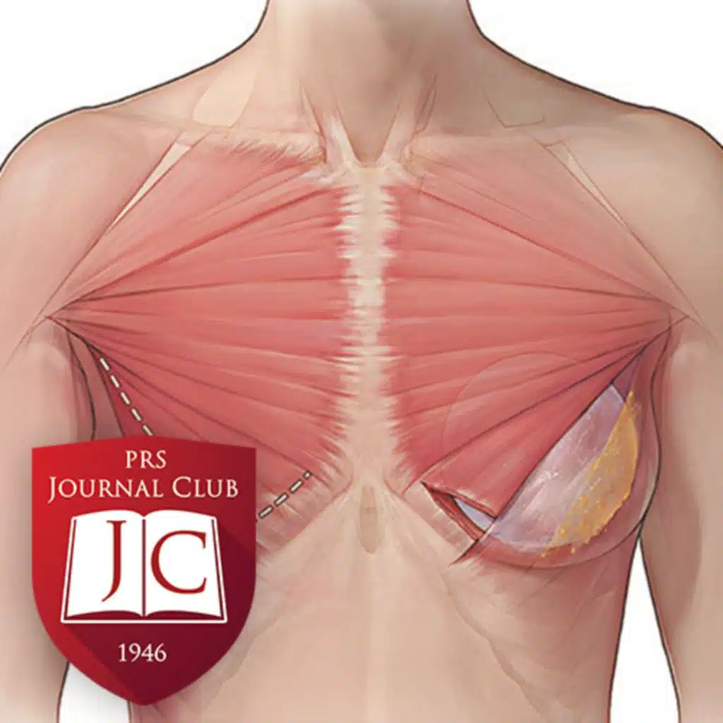 "Subfascial Mini Dual-Plane Augmentation" with Ira Savetsky, MD - Jan. 2025 Journal Club