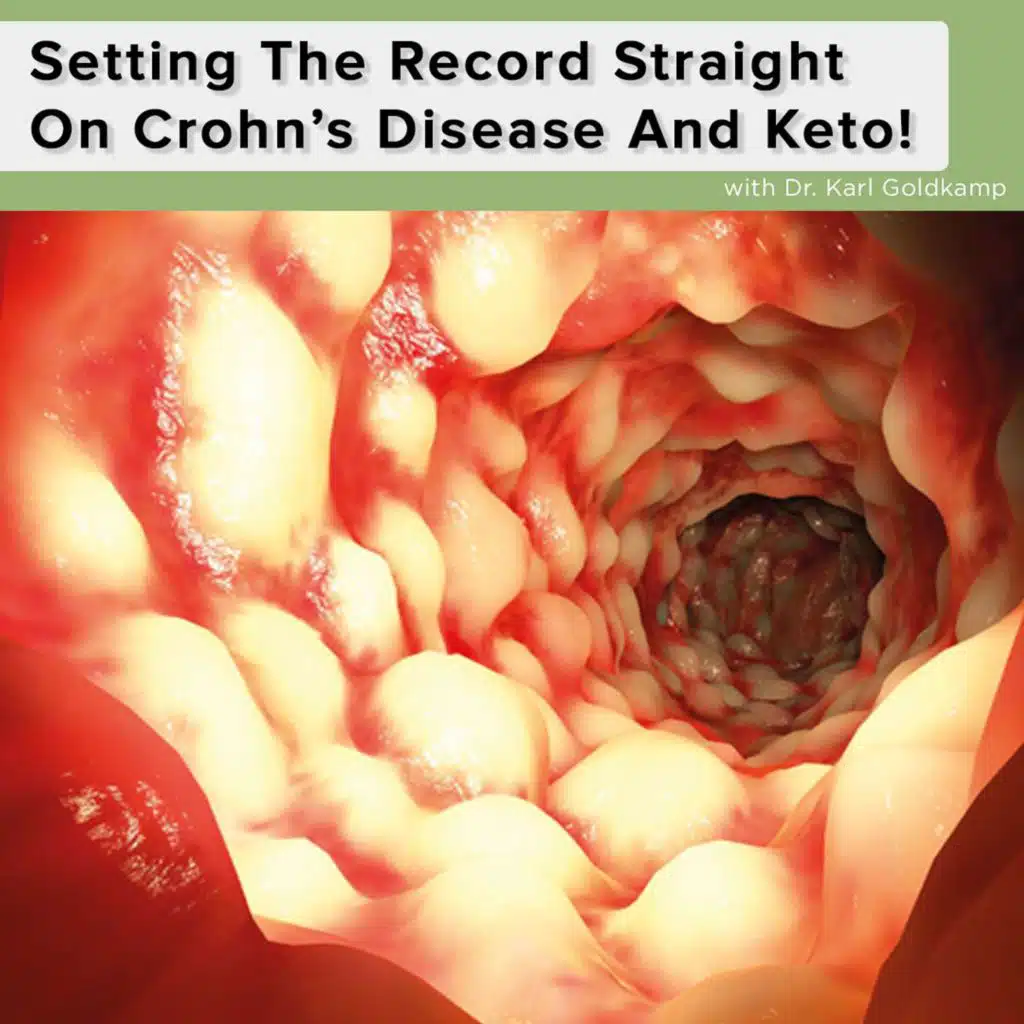 Setting The Record Straight On Crohn's Disease And Keto!