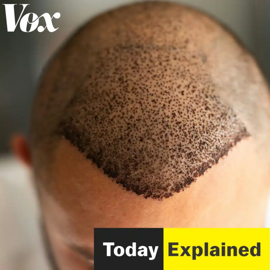 Turkey with the good hair