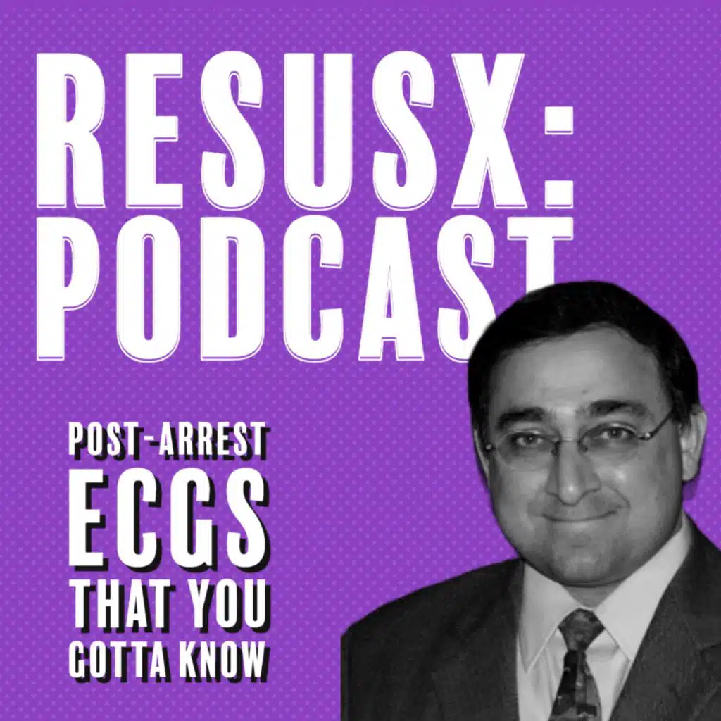 Post-Arrest ECGs That You Gotta Know