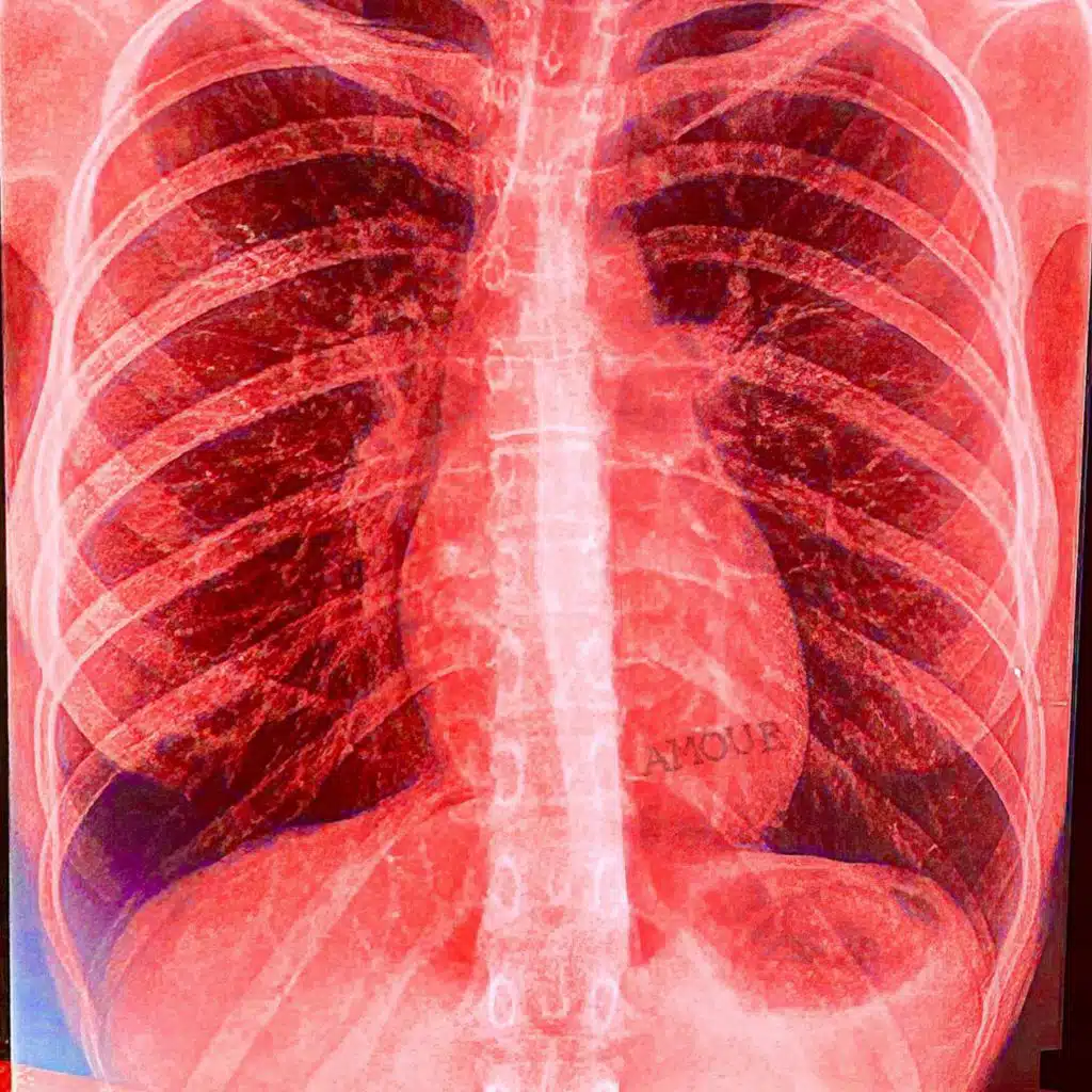 Lounamour Chap.ll EP