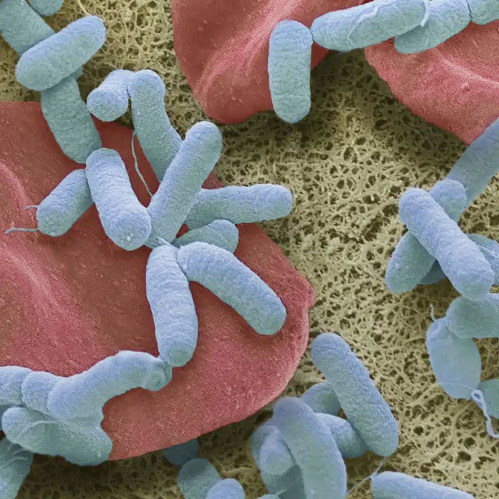 Sepsis Is A Global Killer. Can Vitamin C Be The Cure?