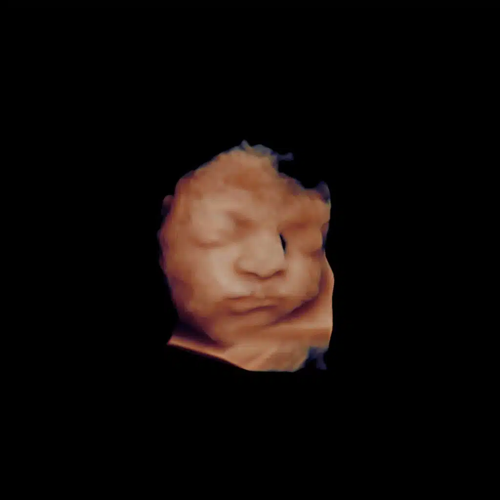 Cessar Fogo (Ao Vivo)