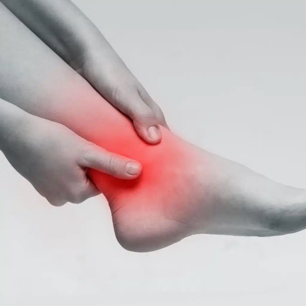 Ankle Injuries