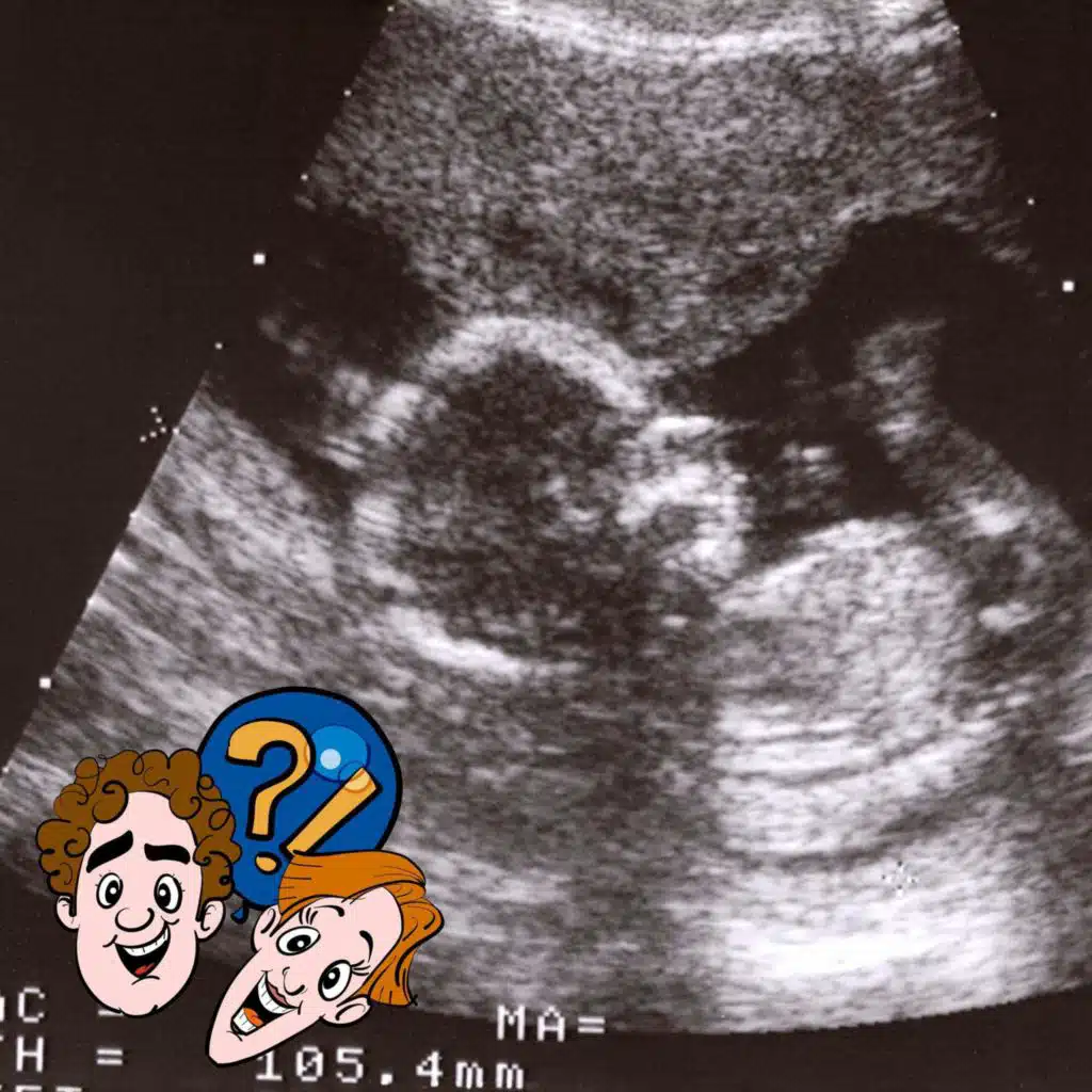 Können sich Babys im Bauch der Mama übergeben?