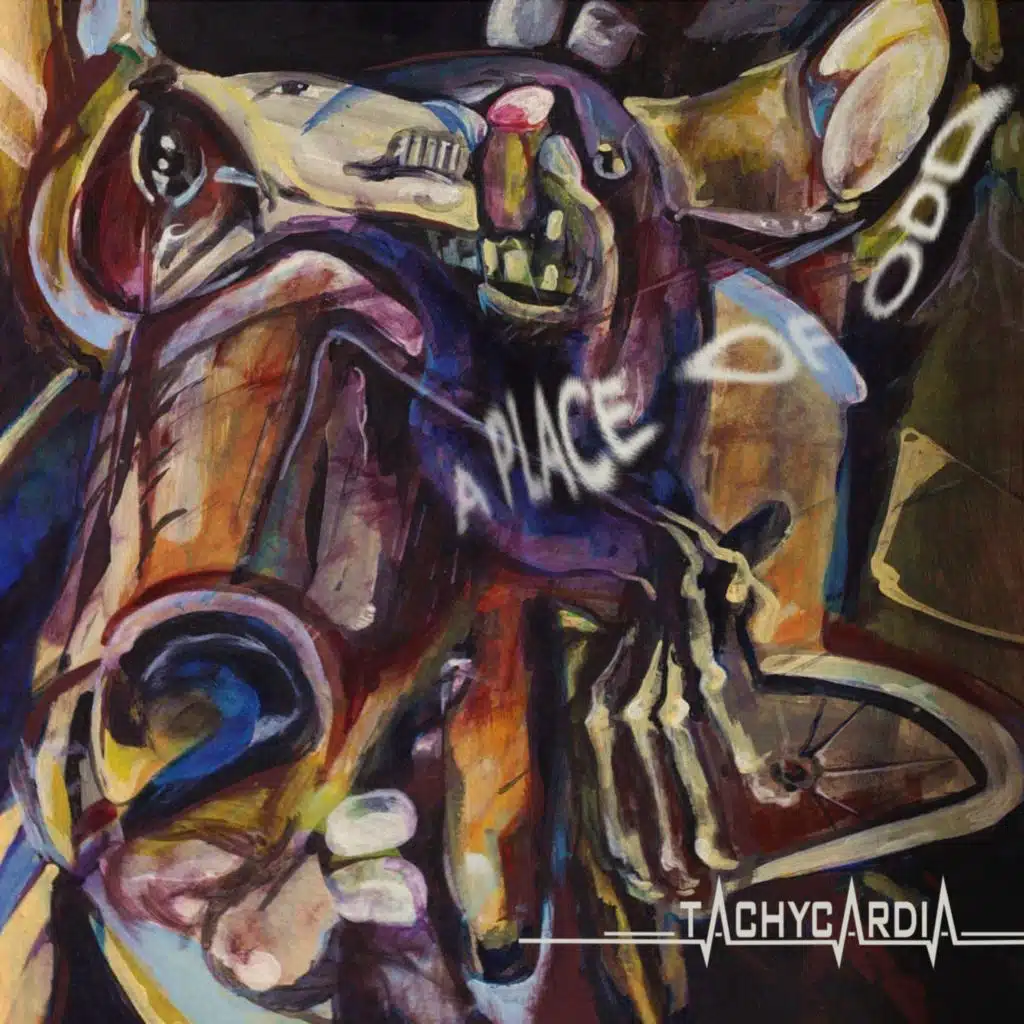 Tachycardia