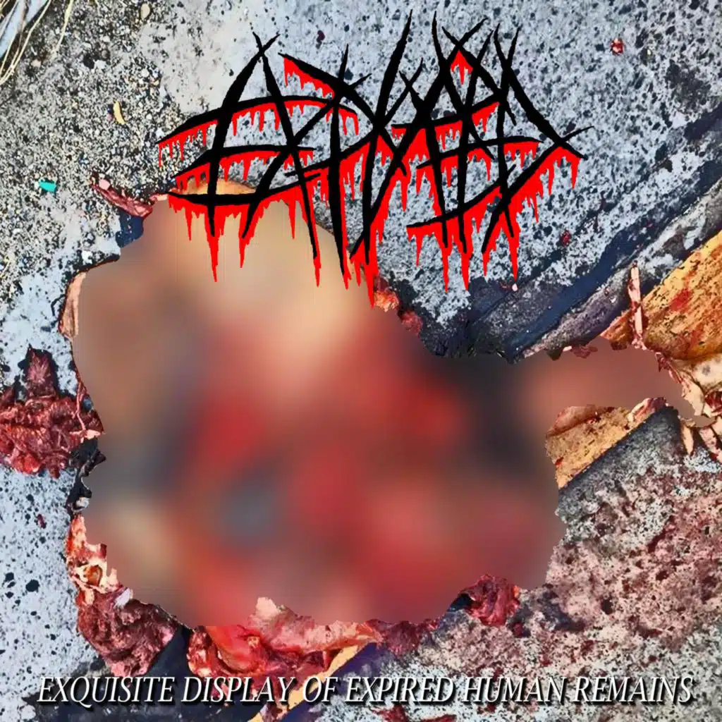 Exsquisite Display Of Expired Human Remains