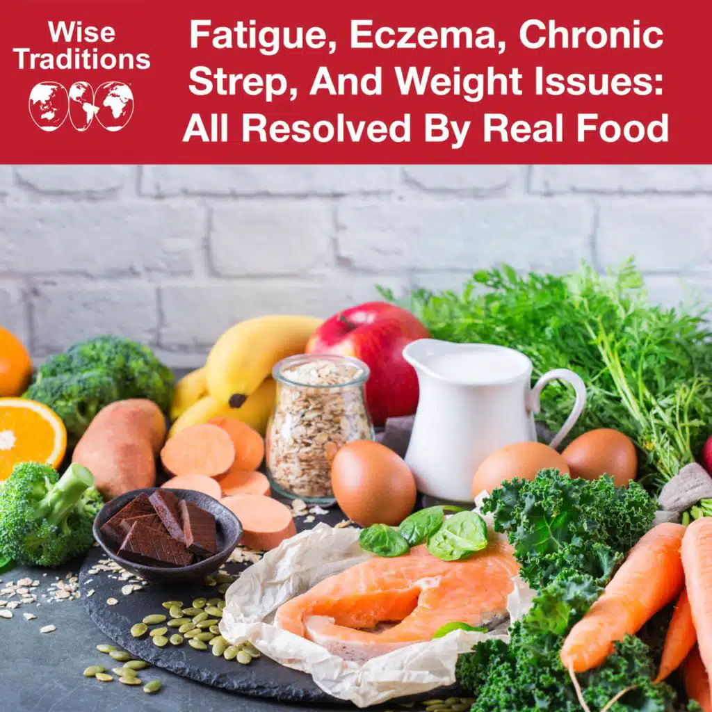 500: Fatigue, Eczema, Chronic Strep, and Weight Issues: All Resolved By Real Food