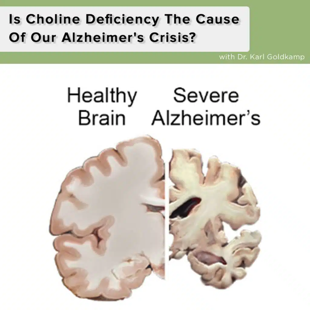 Is Choline Deficiency The Cause Of Our Alzheimer's Crisis?