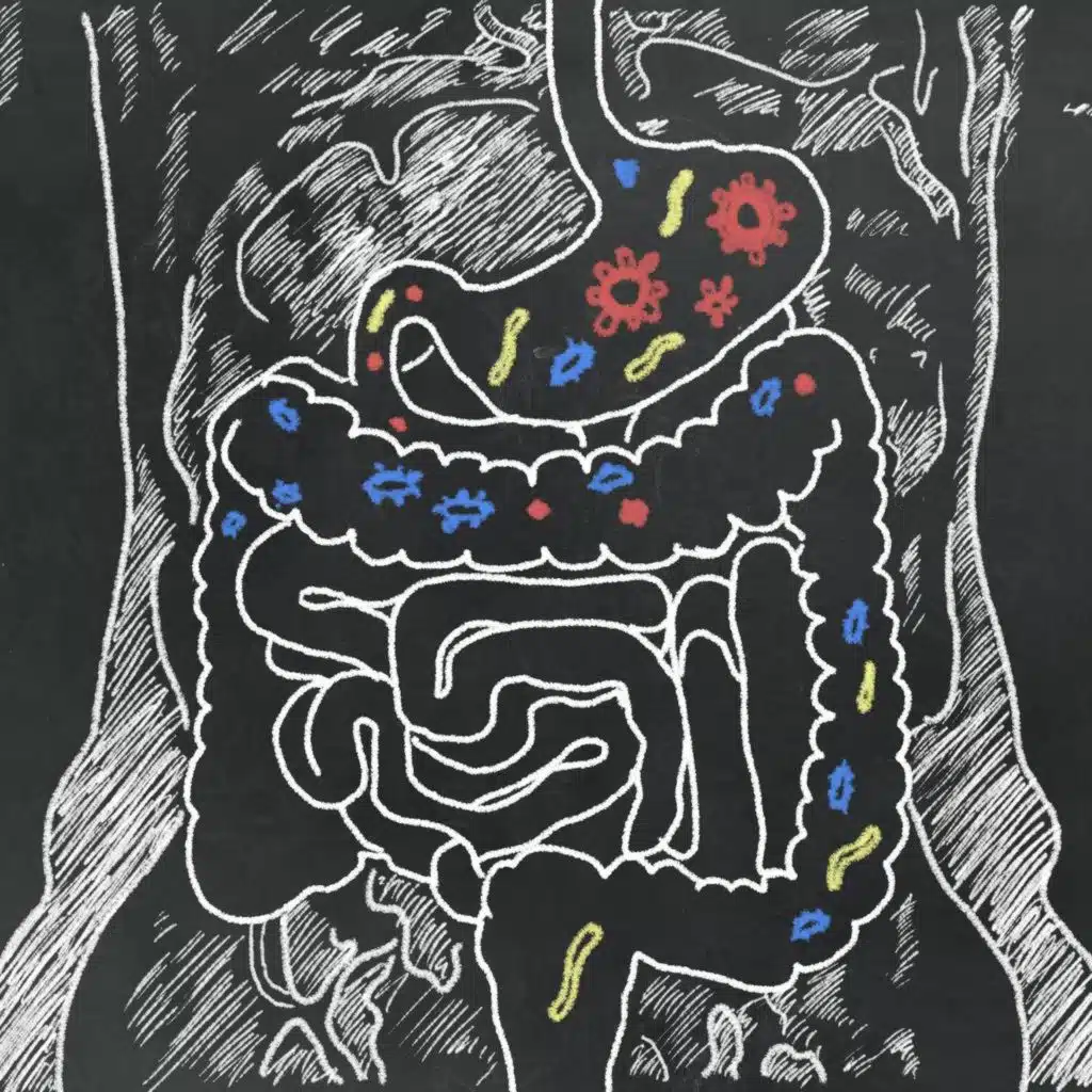 Ask The Expert: On gut health
