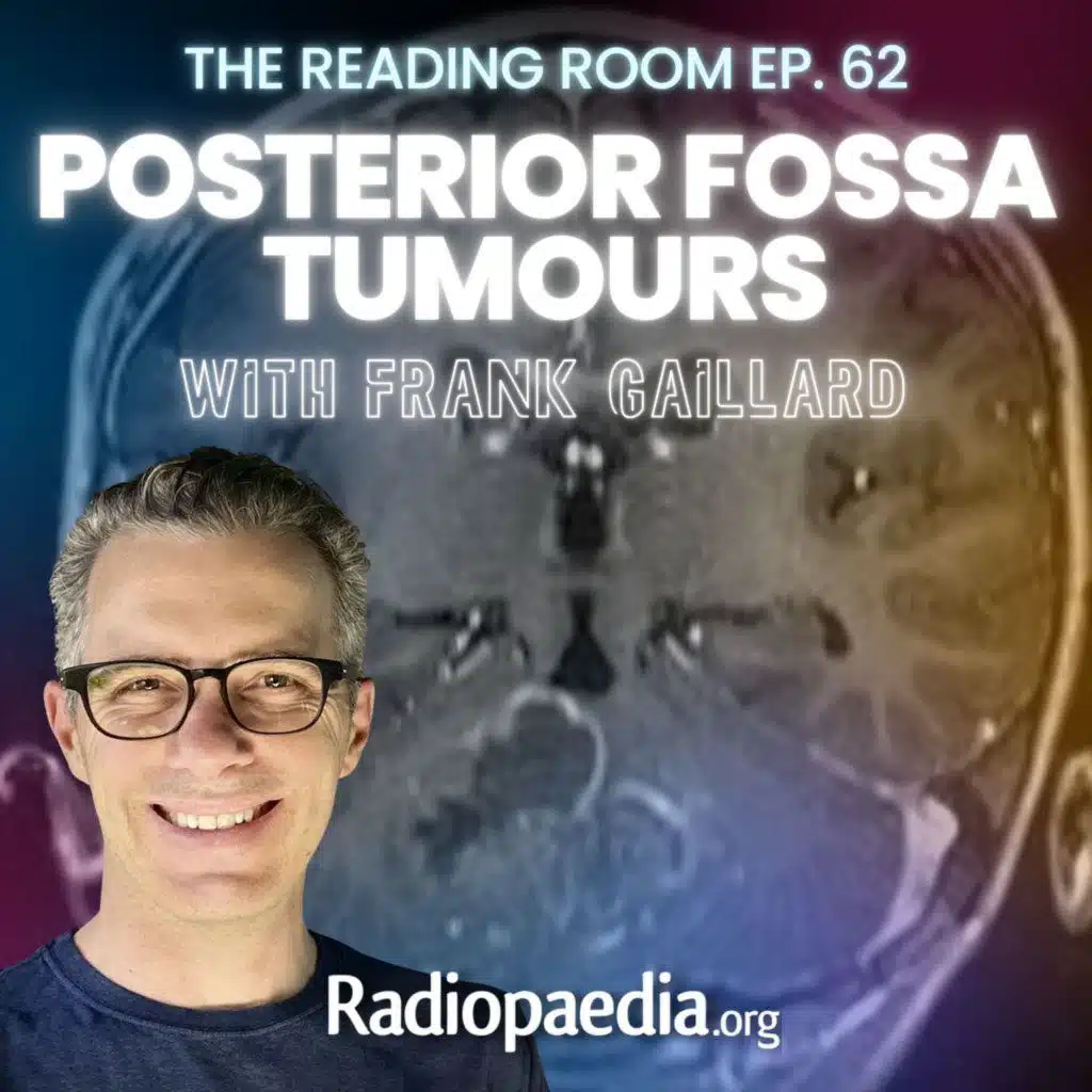 62. Posterior fossa tumours with Frank Gaillard