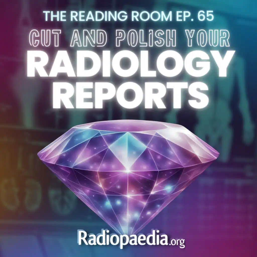 65. Cut and polish your radiology reports
