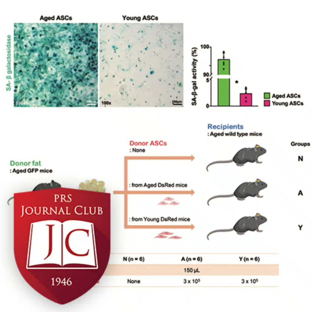 "Young Stromal Cell Effect on Fat Graft" with Chris Campbell, MD - Jun. 2025 Journal Club