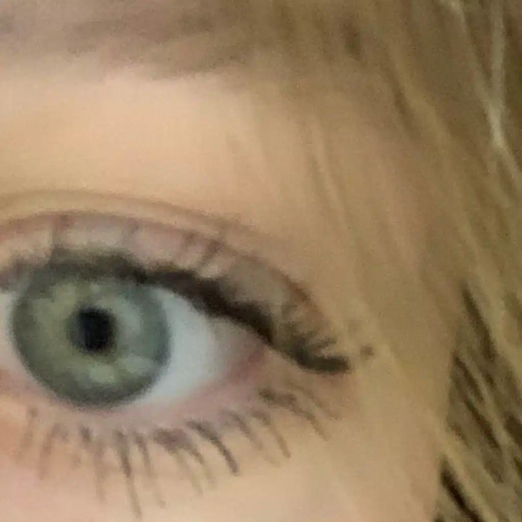 101