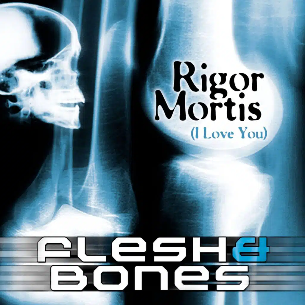 Rigor Mortis (I Love You) (Kyau Vs. Albert Radio Edit)