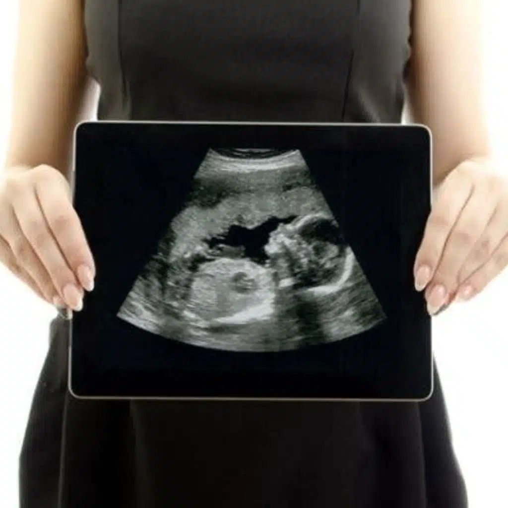 Advanced Maternal Age: Pregnancy After 35