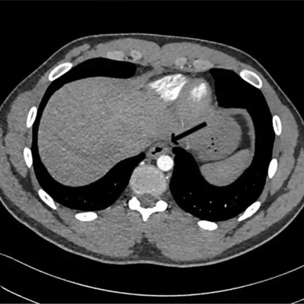 Episode #359: Fever, Rapid Heart Rate, and Difficulty Swallowing in 22-Year-Old Bodybuilder (Medical Mystery)