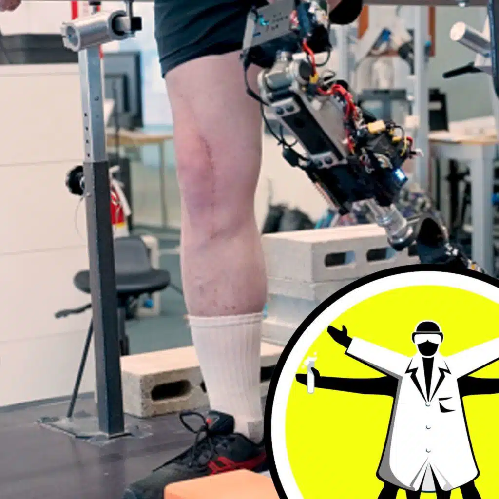 Old drug new tricks, and a sensational bionic leg