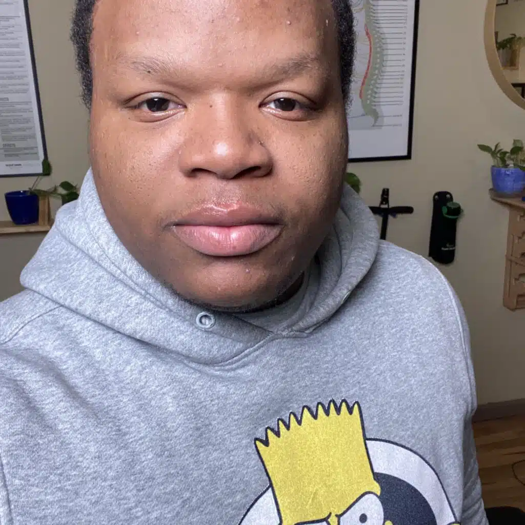 YoungMel