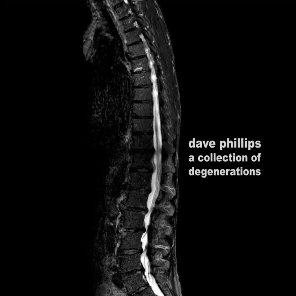 Dave Phillips