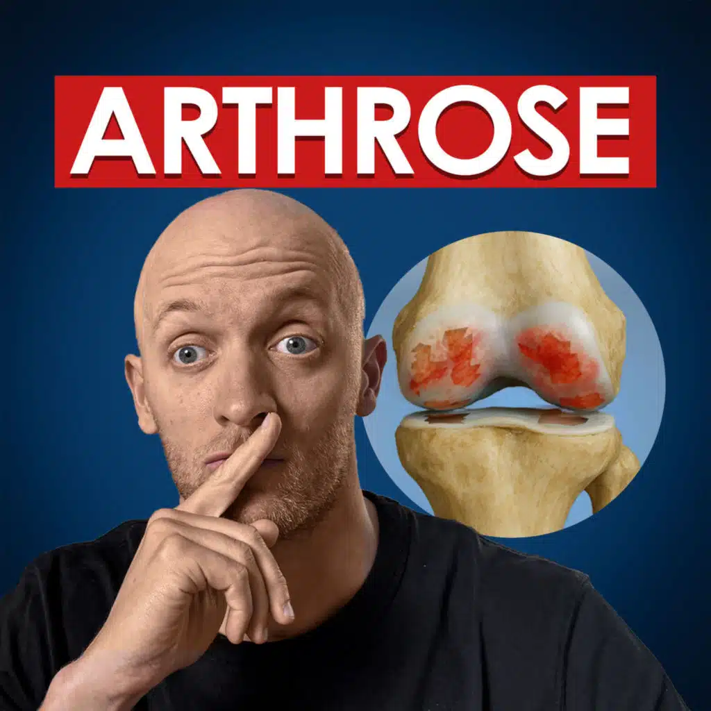 #62 - TOP 10 des aliments ANTI-ARTHROSE