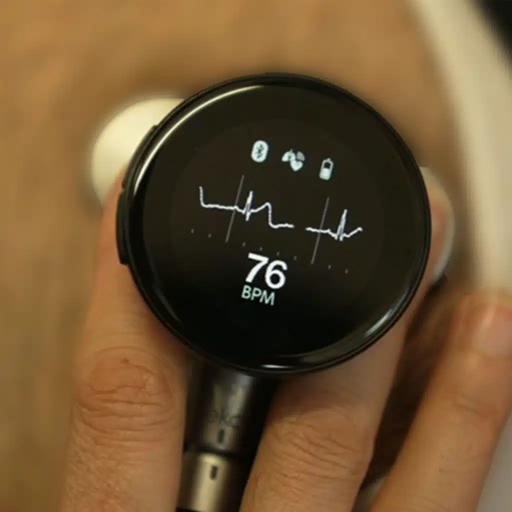 Can we trust AI in health?