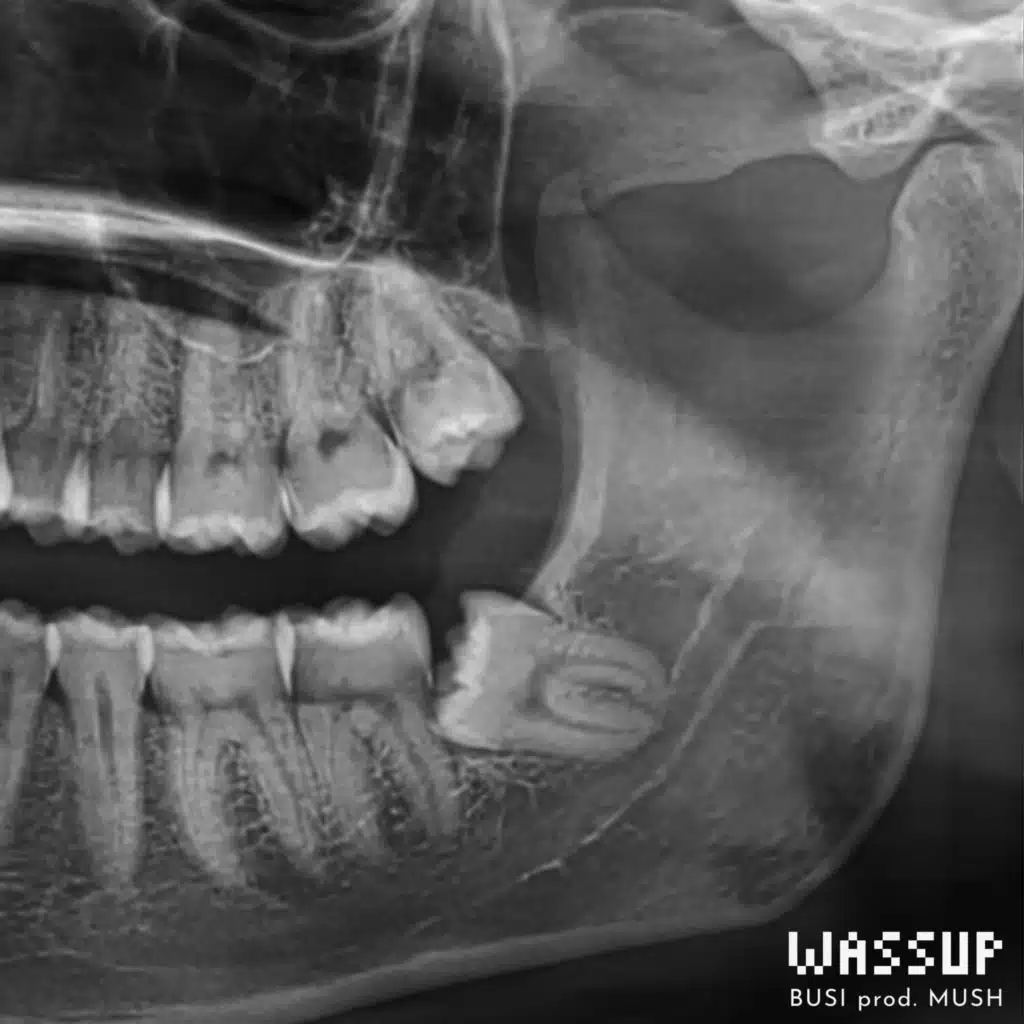 Wassup (feat. Zoo di Venezia)