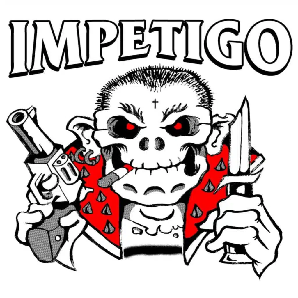 Impetigo