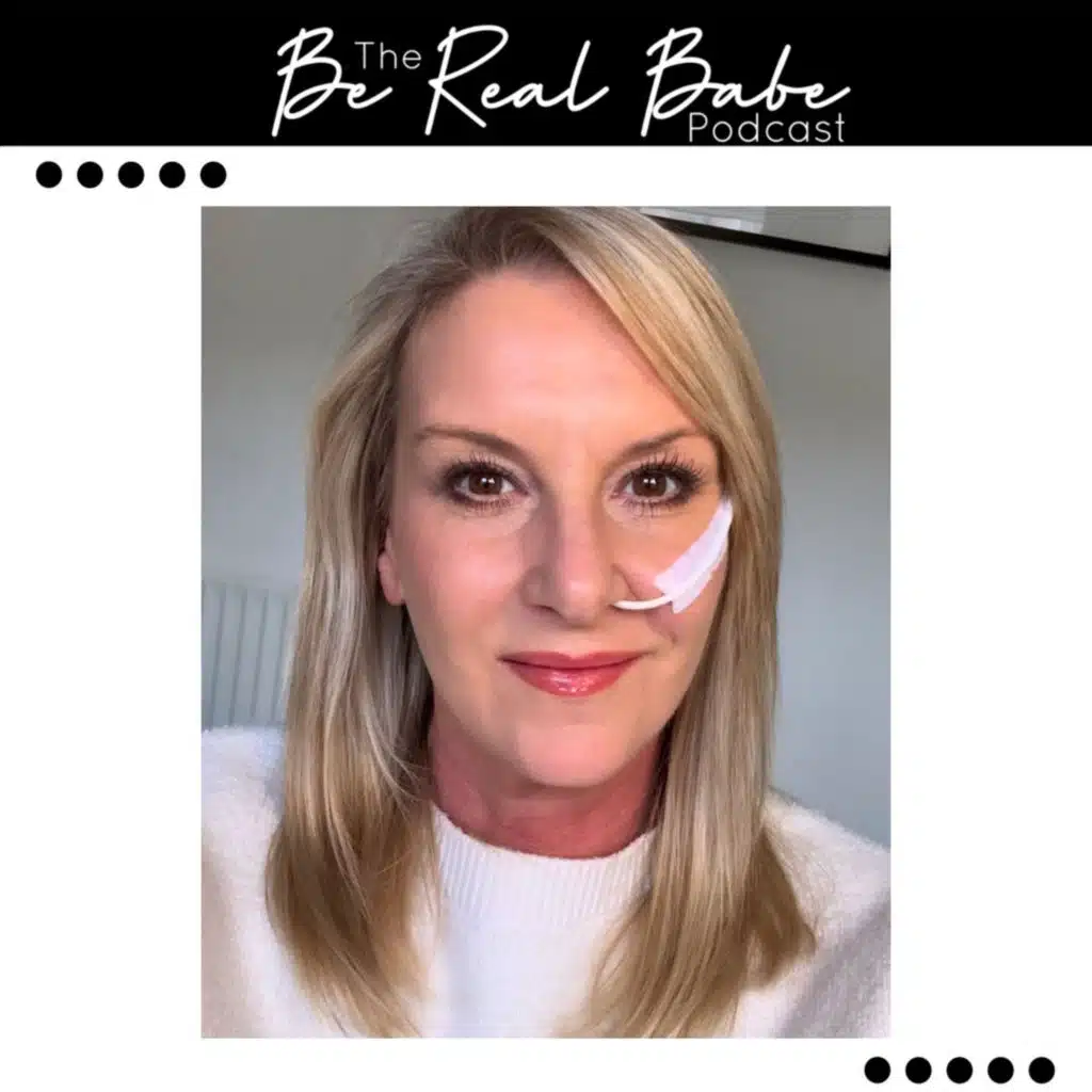 Episode 237 Being real about Botox injury #6